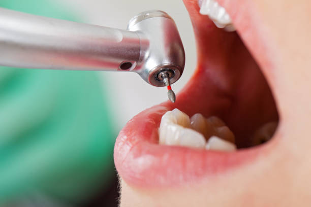 Best Emergency Cosmetic Dentistry in Henderson, TN